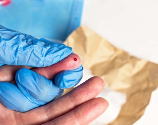 http://www.ultimaenvironmental.com/wp-content/uploads/2022/10/finger-injury-by-needle-505x400-1.jpg