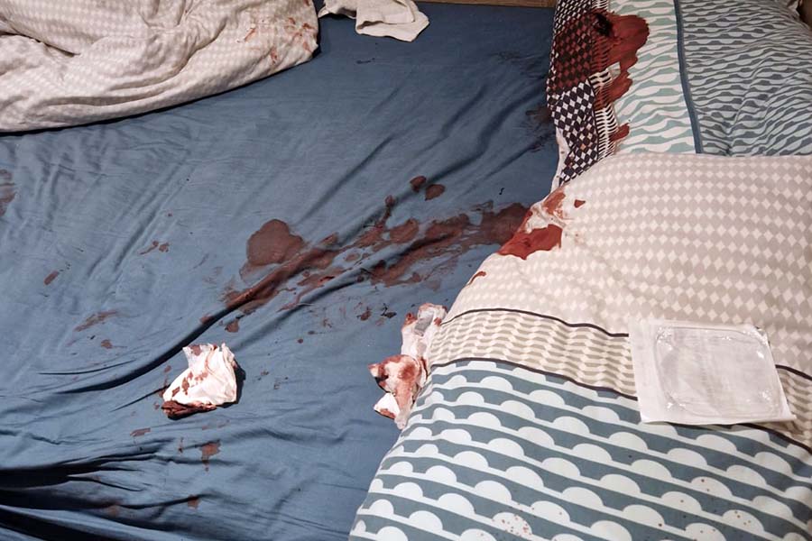 blood-trauma-before